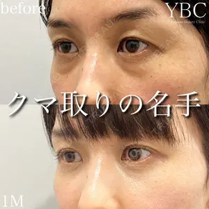 YBC横浜美容外科 池袋院 磯村 亮輔医師の症例