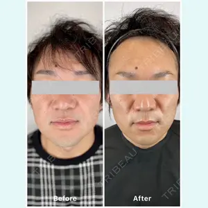 oneUPclinicの症例