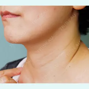 聖心美容クリニック 横浜院 佐々木 直美医師の症例