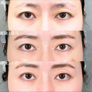 アリエル美容クリニック 大宮院 鈴木　桂介医師の症例