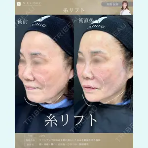症例