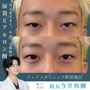 症例