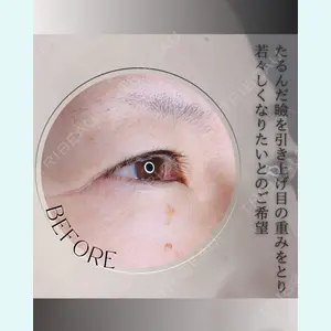 小倉美容外科/美容皮膚科 ビラビューティークリニック 大村 亞蘭医師の症例