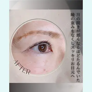 小倉美容外科/美容皮膚科 ビラビューティークリニック 大村 亞蘭医師の症例