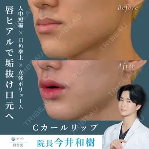 症例