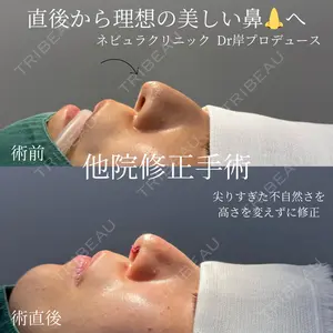 ネビュラクリニック 京都院 岸 大輔医師の症例