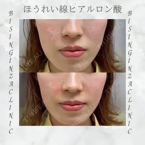 BISIN GINZA CLINICの症例