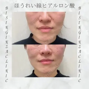 BISIN GINZA CLINICの症例