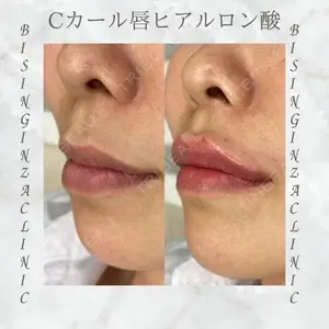 BISIN GINZA CLINICの症例