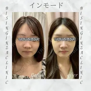 BISIN GINZA CLINICの症例