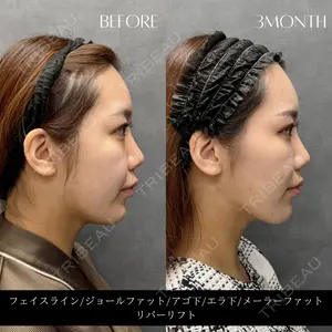 RIVER CLINIC（リバークリニック）大阪院 木家 佑理子医師の症例