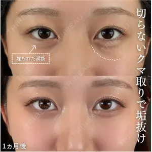 T CLINIC 新宿院【ティークリニック】の症例