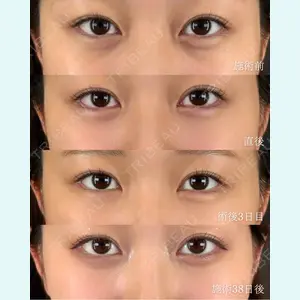 T CLINIC 新宿院【ティークリニック】の症例