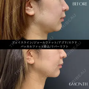 RIVER CLINIC（リバークリニック）の症例