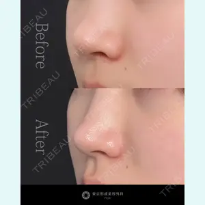 東京形成美容外科 池袋院 弓削田　浩主医師の症例