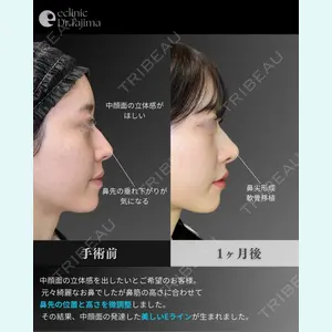 eクリニック 岡山院 田嶋 隼也医師の症例