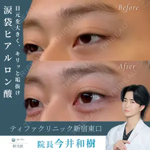 症例