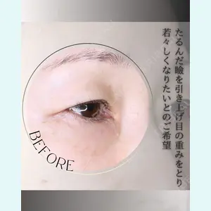 小倉美容外科/美容皮膚科 ビラビューティークリニック 大村 亞蘭医師の症例