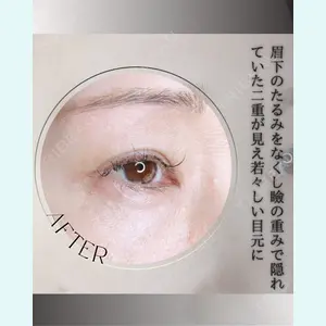 小倉美容外科/美容皮膚科 ビラビューティークリニック 大村 亞蘭医師の症例