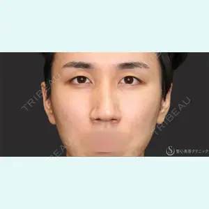 聖心美容クリニック 名古屋院 加藤 大典医師の症例