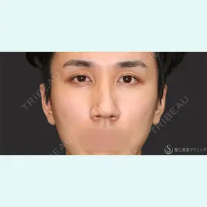 聖心美容クリニック 名古屋院 加藤 大典医師の症例