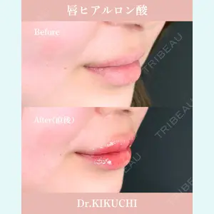 ルラ美容クリニック 広島院 角南 亮輔医師の症例