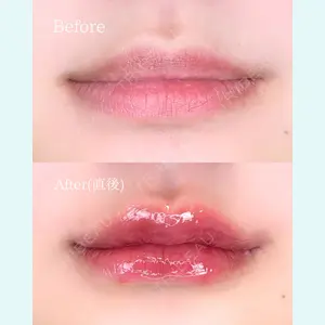 ルラ美容クリニック 広島院 角南 亮輔医師の症例