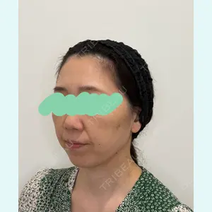 Olivia Clinic 山﨑 香名医師の症例