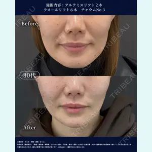 LA MER CLINIC 辻 航平医師の症例