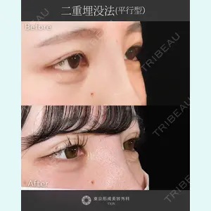 東京形成美容外科 船橋院 山崎 修吾医師の症例