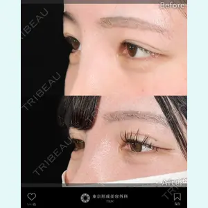 東京形成美容外科 船橋院 山崎 修吾医師の症例