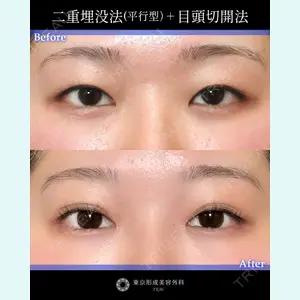 東京形成美容外科 船橋院 山崎 修吾医師の症例