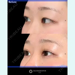 東京形成美容外科 船橋院 山崎 修吾医師の症例