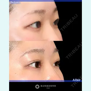 東京形成美容外科 船橋院 山崎 修吾医師の症例