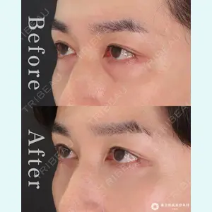 東京形成美容外科 池袋院の症例