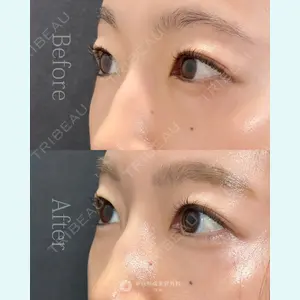 東京形成美容外科 池袋院の症例