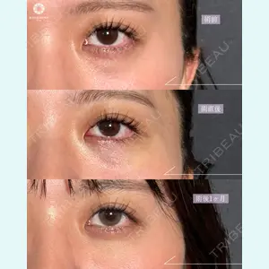 東京形成美容外科 池袋院の症例