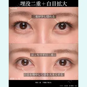 Zetith Beauty Clinic 銀座院 小川 悟史医師の症例