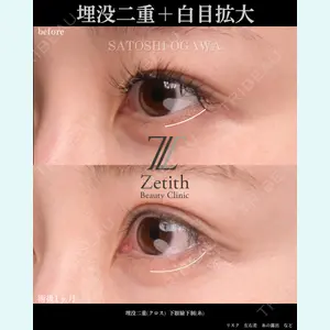 Zetith Beauty Clinic 銀座院 小川 悟史医師の症例