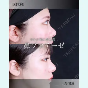 小倉美容外科/美容皮膚科 ビラビューティークリニック 大村 亞蘭医師の症例