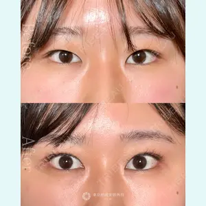 東京形成美容外科 池袋院 弓削田　浩主医師の症例