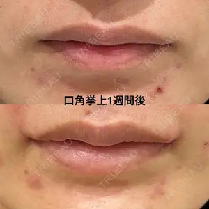 エターナル美容クリニック 久門田 詳医師の症例