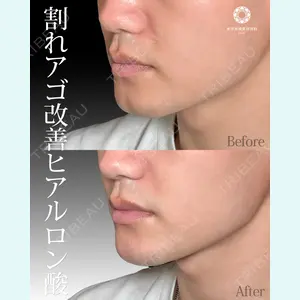 東京形成美容外科 船橋院 山崎 修吾医師の症例