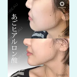 東京形成美容外科 船橋院 山崎 修吾医師の症例