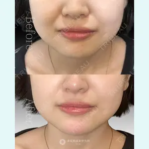 東京形成美容外科 船橋院 山崎 修吾医師の症例