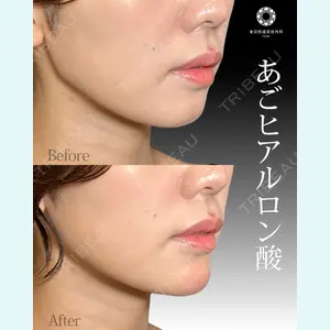 東京形成美容外科 船橋院 山崎 修吾医師の症例