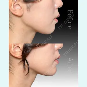 東京形成美容外科 船橋院 山崎 修吾医師の症例