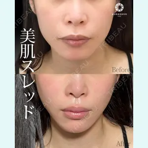 東京形成美容外科 船橋院 山崎 修吾医師の症例