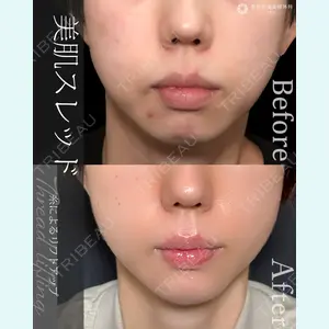 東京形成美容外科 船橋院 山崎 修吾医師の症例