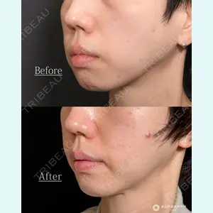 東京形成美容外科 船橋院 山崎 修吾医師の症例